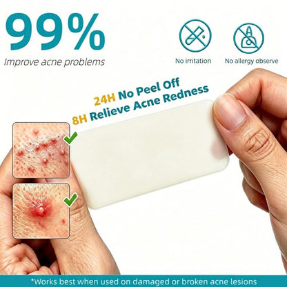 Hydrocolloid Acne Patch Roll