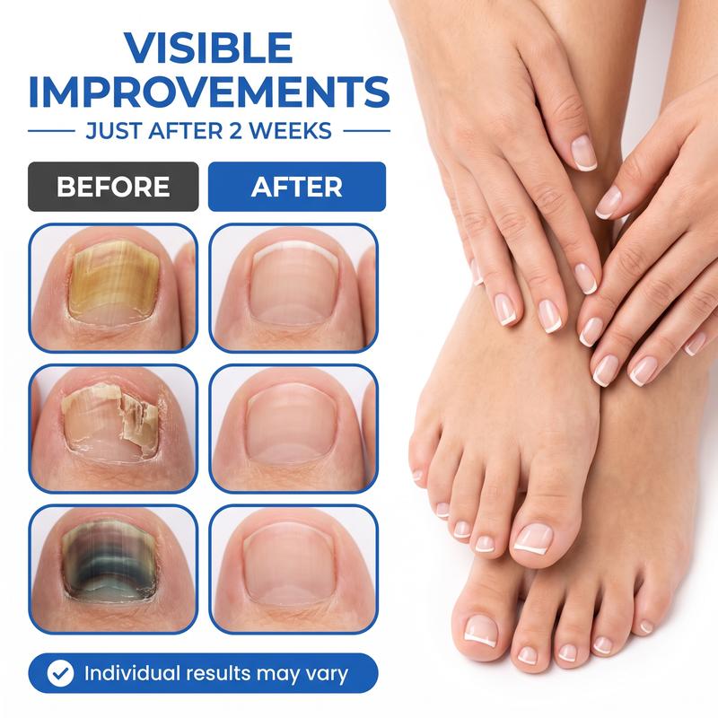 Toenail Fungus Defense Treatment