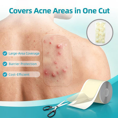 Hydrocolloid Acne Patch Roll
