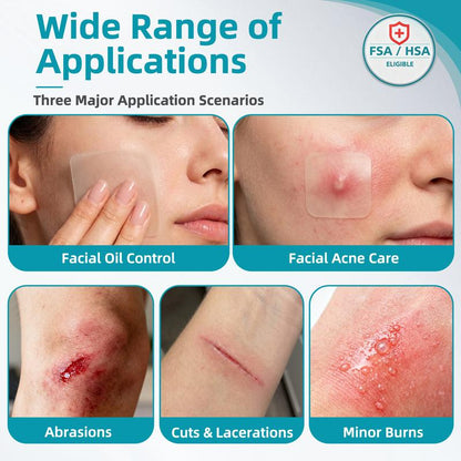 Hydrocolloid Acne Patch Roll