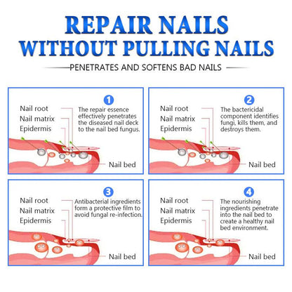 Toenail Fungus Defense Treatment
